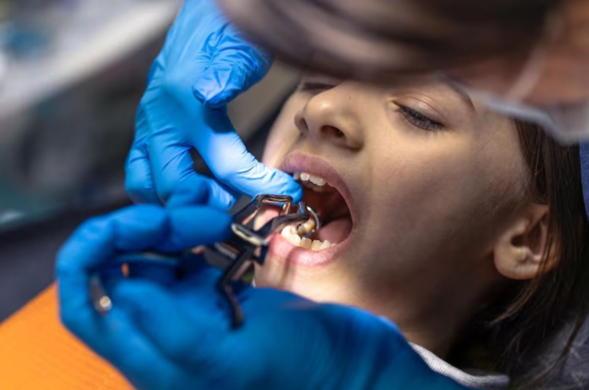 Tooth Extraction